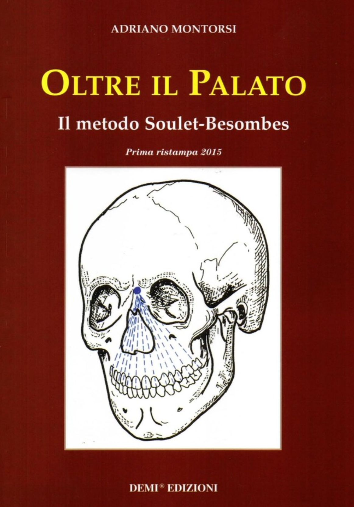 Oltre il palato - Il metodo Soulet - Besombes