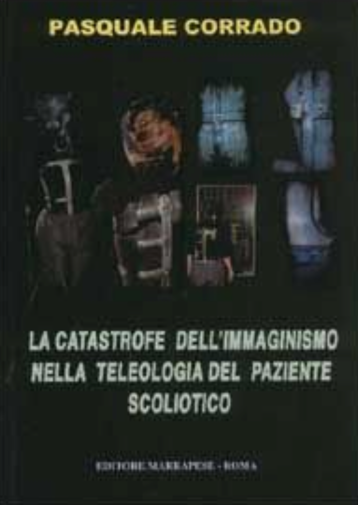 La catastrofe dell'immaginismo nella teleologia del paziente scoliotico