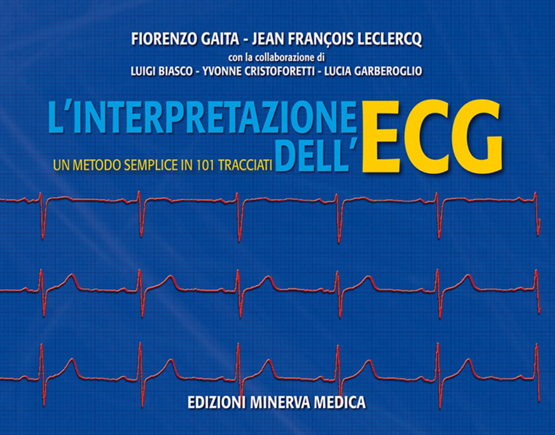 L'interpretazione dell'Ecg - Un metodo semplice in 101 tracciati