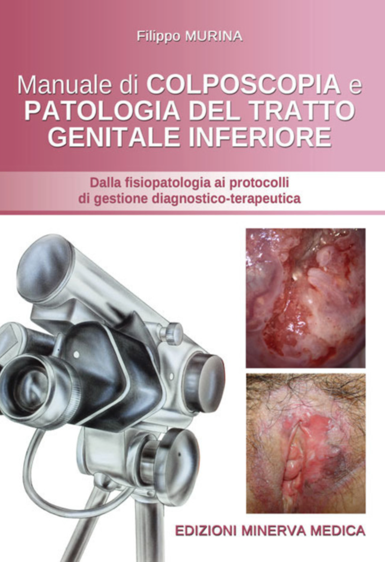 Manuale di colposcopia e patologia del tratto genitale inferiore - Dalla fisiopatologia ai protocolli di gestione diagnostico - terapeutica