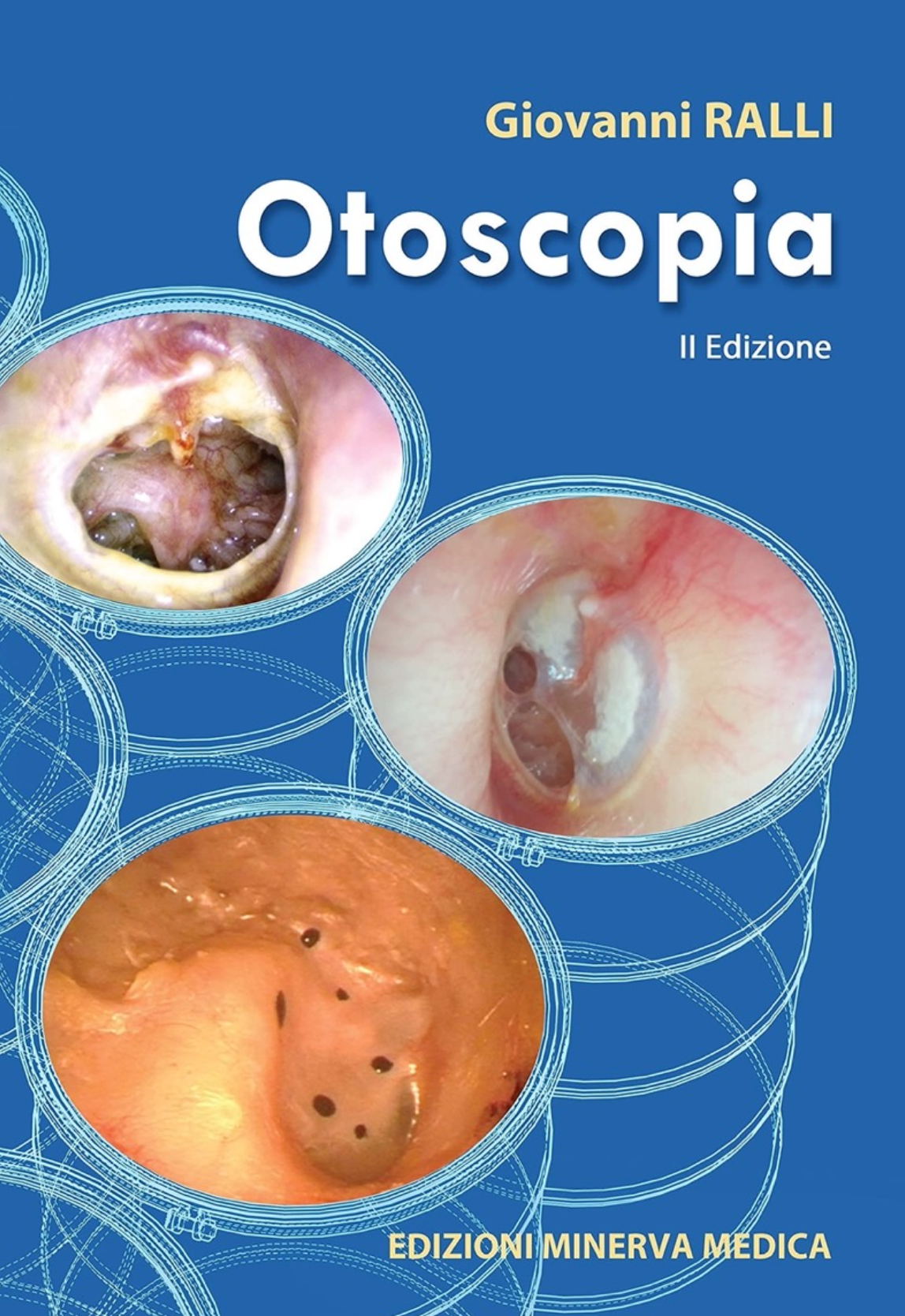 Otoscopia