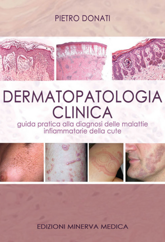 Dermatopatologia clinica - Guida pratica alla diagnosi delle malattie infiammatorie della cute