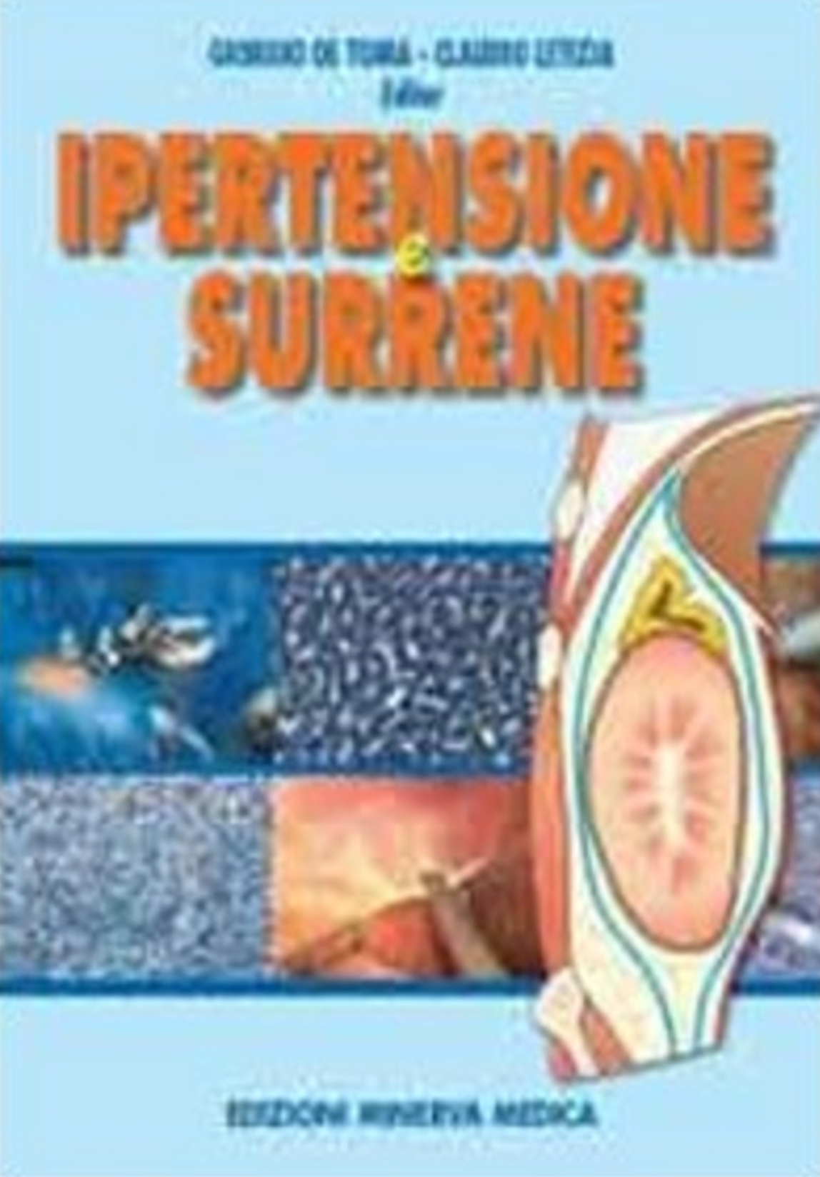 Ipertensione e surrene