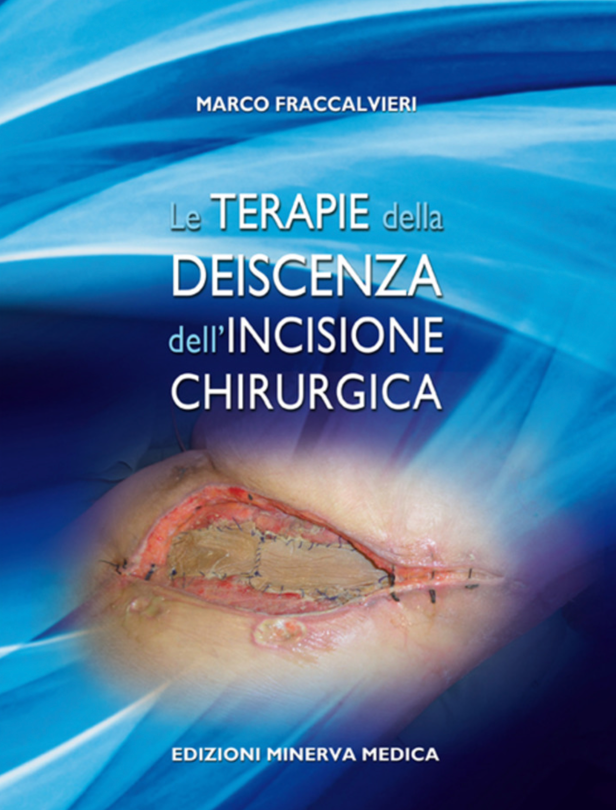 Le terapie della deiscenza dell' incisione chirurgica