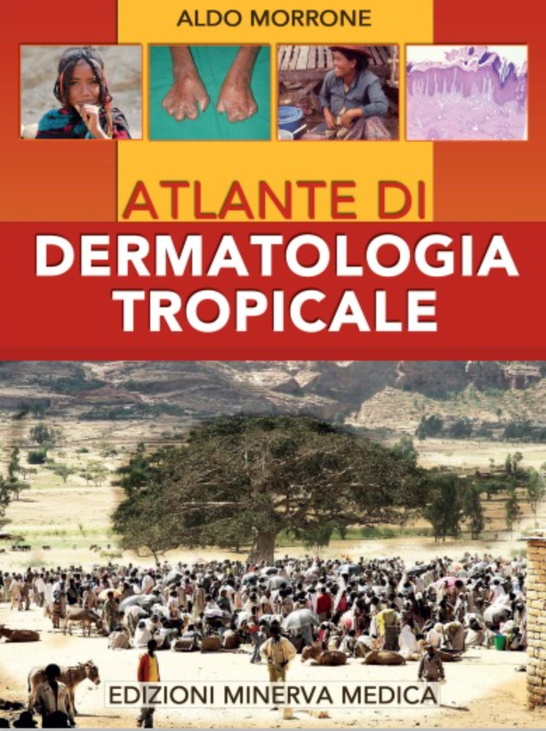 Atlante di dermatologia tropicale