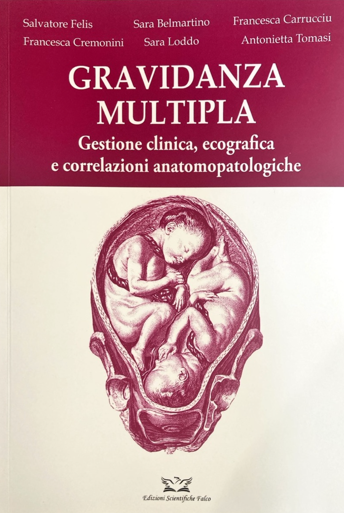 Gravidanza multipla - Gestione clinica, ecografica e correlazioni anatomopatologiche