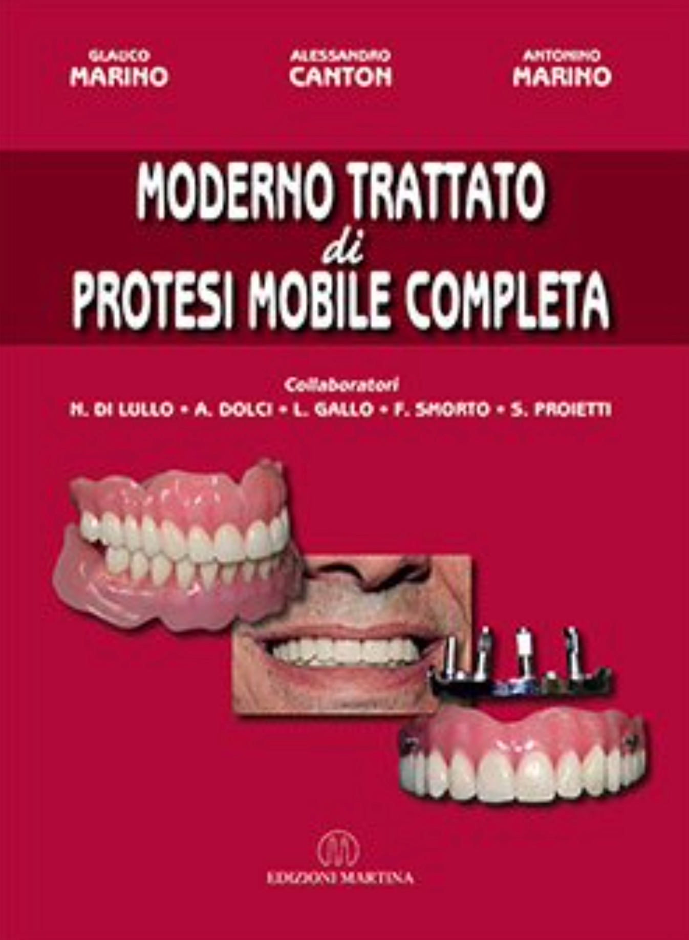 Moderno Trattato di protesi Mobile Completa