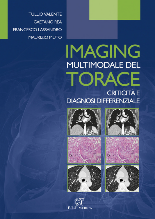 Imaging multimodale del torace - Criticità  e diagnosi differenziale